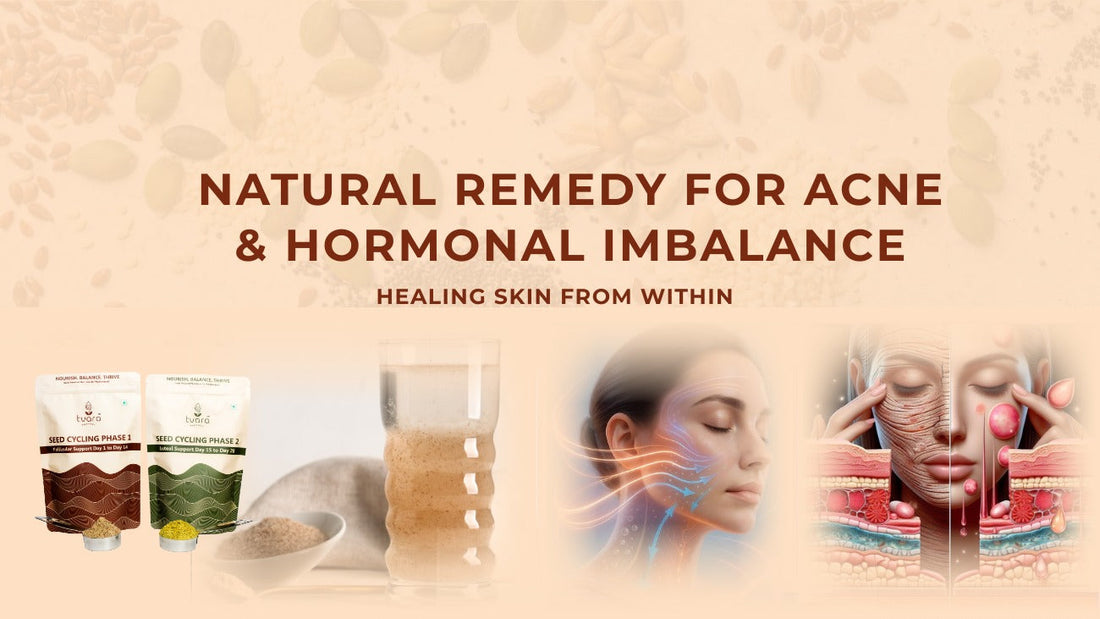 Natural Remedy for Acne & Hormonal Imbalance